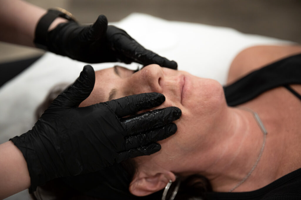 a dermatologist performing a chemical peel on a female patient for a hyperpigmentation treatment in Fort Lauderdale