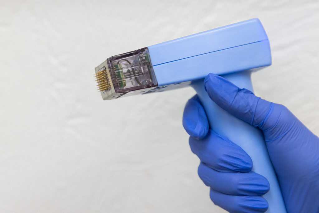 A gloved hand holding the Morpheus8 handheld device for head-to-toe skin tightening in Fort Lauderdale.