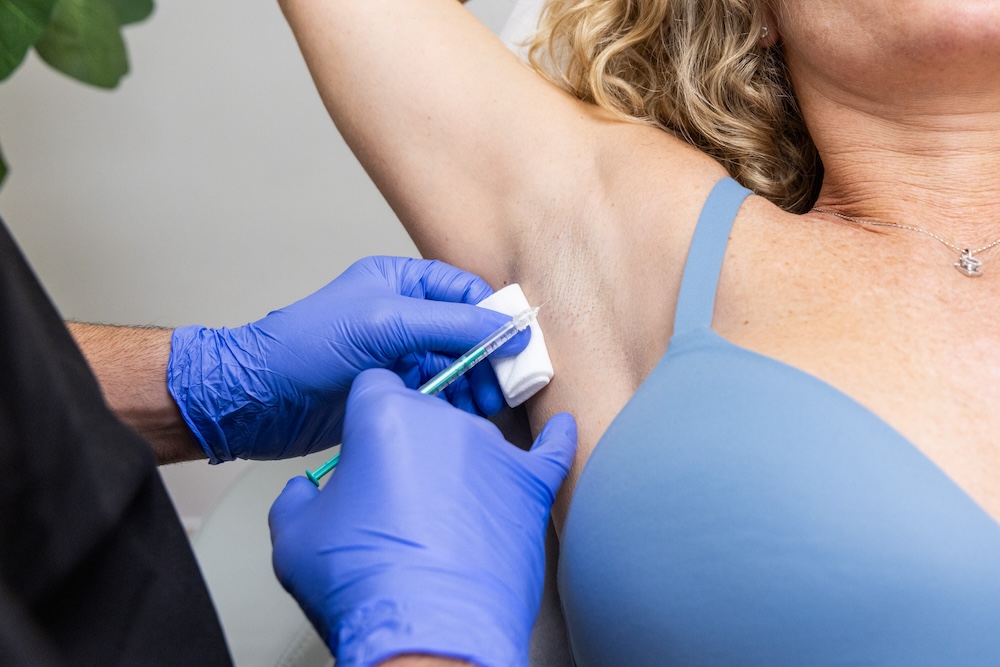 Dermatologist injecting Botox into his patient's armpit as part of an excessive sweating treatment in Fort Lauderdale.